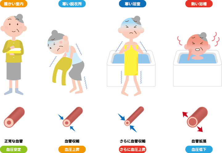 ヒートショックの原因